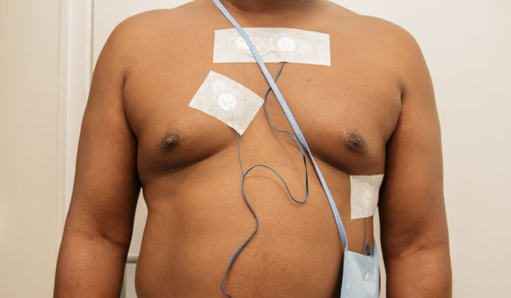 Holter Monitoring: 24 or 48 hours ECG
